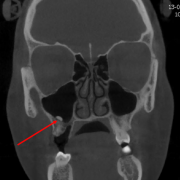 fig 4p fig 4p