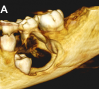 fig 3-alk fig 3-alk